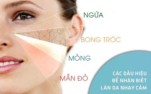 Da nhạy cảm dễ bị ửng đỏ, kích ứng khi tiếp xúc với mỹ phẩm