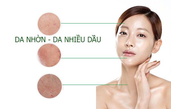 Da dầu dễ nhận biết bằng mắt thường