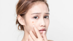 mỹ phẩm đặc trị